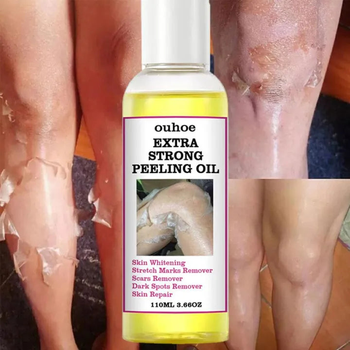 Yellow Peeling Oil 110ml Dead Skin Remover Arbish Store