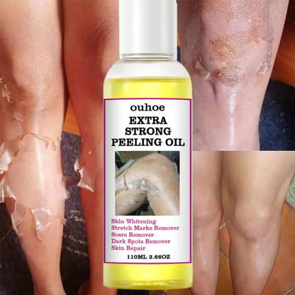 Yellow Peeling Oil 110ml Dead Skin Remover Arbish Store