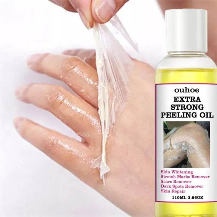 Yellow Peeling Oil 110ml Dead Skin Remover Arbish Store