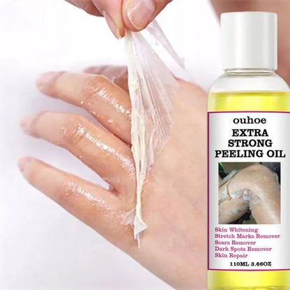 Yellow Peeling Oil 110ml Dead Skin Remover Arbish Store