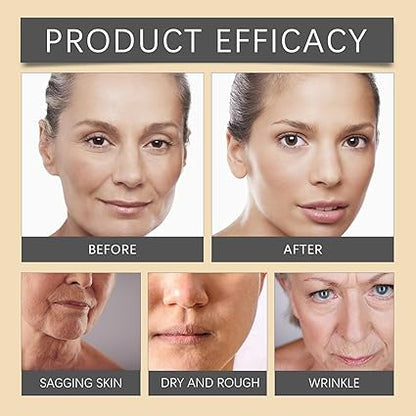 Bee Venom Botox Wrinkle Cream Arbish Store