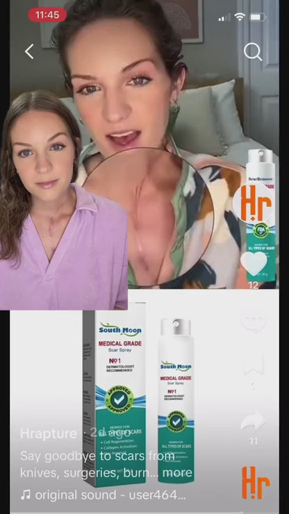 South Moon Medical Grade Scar Spray – Silicone Scar Care Spray for Old & New Scars | 20g