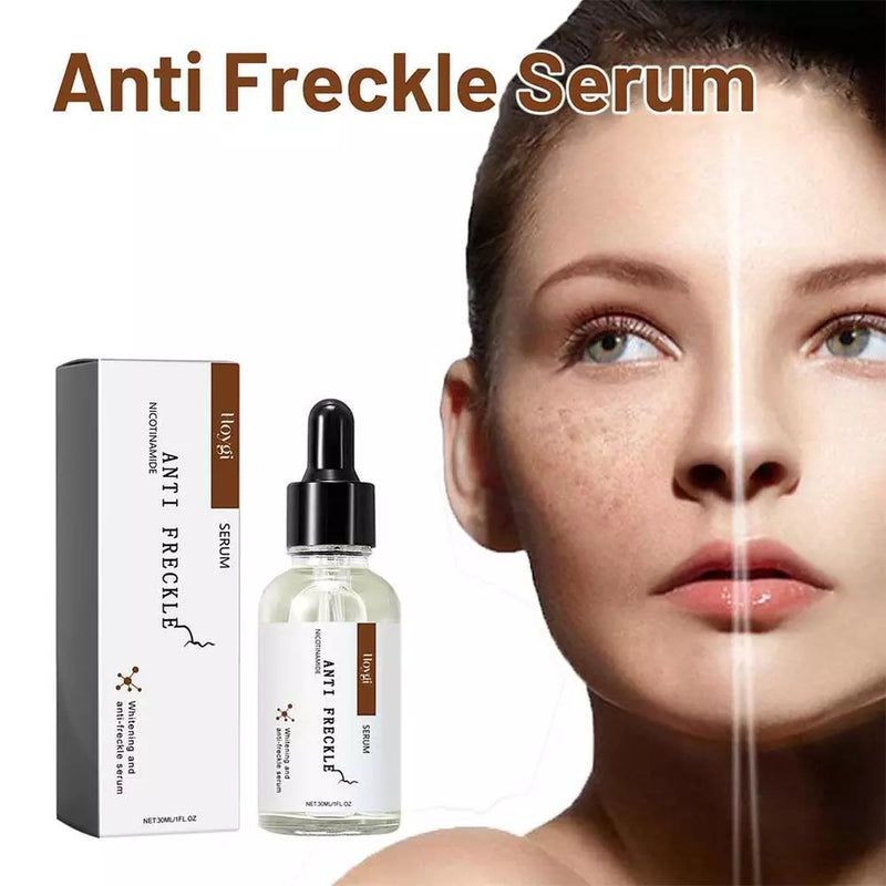 Hoygi Nicotinamide Anti Freckle Face Serum – Brightening Dark Spot & Uneven Skin Tone Care | 30ml Arbish Store