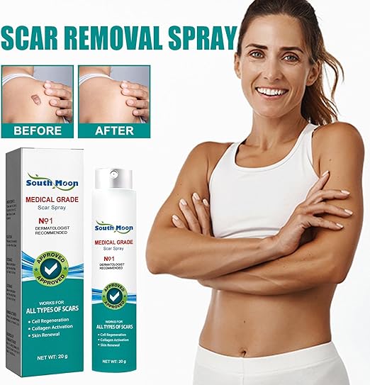 South Moon Medical Grade Scar Spray – Silicone Scar Care Spray for Old & New Scars | 20g Arbish Store
